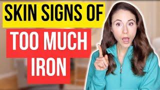 9 SIGNS OF TOO MUCH IRON // DERMATOLOGIST @DrDrayzday