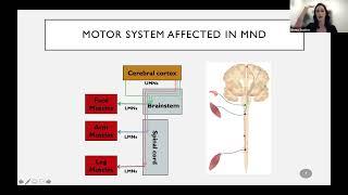 Motor Neuron Disease; Who develops it, why, and what we are doing about it?