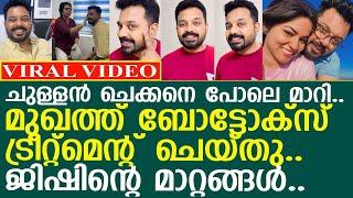 ജിഷിൻ മുഖത്ത് മുഴുവൻ ബോട്ടോക്സ് ട്രീറ്റ്മെന്റ് എടുത്തു..! l Jishin Mohan