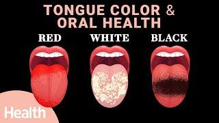 What Your Tongue Tells You About Your Health | Tongue Color, Taste Buds, COVID Tongue, & Oral Health