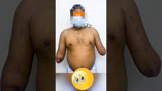 Man Gets New Life 