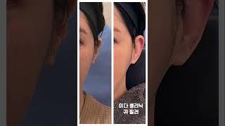연예인들 께서 많이 하시는 필러가 어떤 필로인지 아시나요?