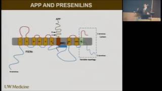 Some Alzheimer's disease research