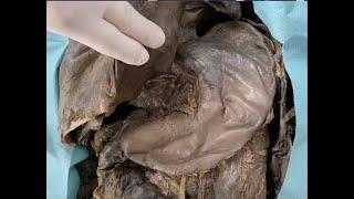 The stomach/Stomacul (dissection)