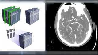 Maximum Intensity Projection (MIP) Reconstructions