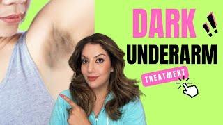 Underarm pigmentation darkness treatment | treatment for dark underarms | Nipun Kapur