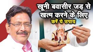 खूनी बवासीर जड़ से खत्म करने के लिए करें ये उपाय | Hakim Suleman khan | Sadhna Tv