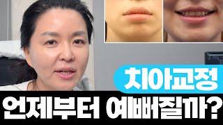 그래서 교정 시작하고 언제부터 예뻐지냐고요!!