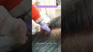 Treatment for hair growth/#skincare #hairgrowth #haircare #hair #hairshampoo #doctor #youtube #yt