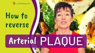 How to reverse ARTERIAL PLAQUE buildup (part 1)