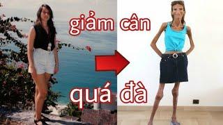 Ám ảnh với cô gái gầy nhất thế giới, cơ thể chỉ có da bọc xương