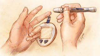 Glucose Self-monitoring in Non–Insulin-Treated Patients With Type 2 Diabetes