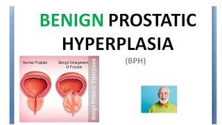 Surgery 979 a BPH Benign Prostate Zone hyperplasia Symptom Differential Complication IPSS Prostatism