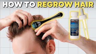 How to Microneedle with Minoxidil for Best Hair Results | AL GARRIDO