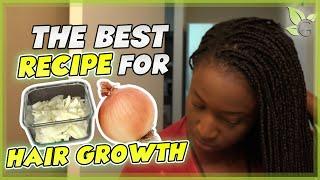 The BEST Onion Juice Recipe for Maximum HAIR GROWTH!