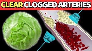 Top 7 BEST Vegetables To CLEAN Arteries And PREVENT Heart Attack.| Vitality Solutions