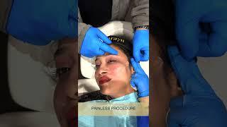 Korean Facelift by Dr. Adarsh Tripathi