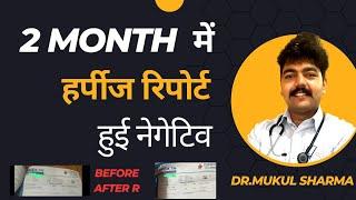 2 Month में हुआ HSV हर्पीज पूरी तरह ठीक - Genital herpes: Treatment & Management