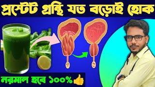 প্রস্টেট গ্ল্যান্ড ছোট করার জাদুকরী পদ্ধতি || PROSTATE GLAND SHRINKING Secrets Revealed! ||