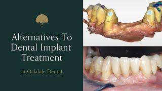 Alternatives to dental implant treatment