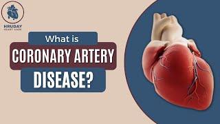 DR MANISH GARG | HRUDAY HEART CARE | HEART SURGEON IN MUMBAI | CORONARY ARTERY DISEASE