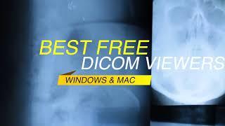 Best DICOM Viewers