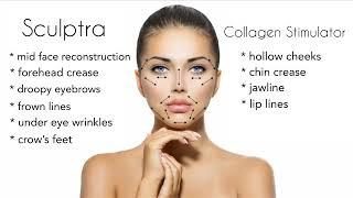 Sculptra vs Dermal Fillers