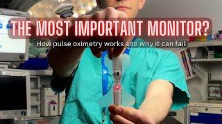 How oxygen monitoring works in anesthesia (and when it doesn’t)