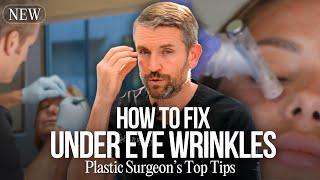 What To Do About Your Under Eye Wrinkles!