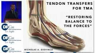 Tendon Transfer for TMA: Restoring Balance to the Forces