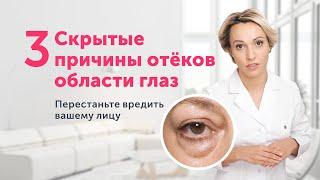 ОТЁКИ И МЕШКИ под глазами: НЕОЖИДАННЫЕ причины и одно полезное упражнение