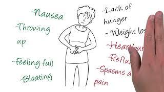 Understanding diabetic gastroparesis