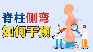 孩子脊柱侧弯不恐慌！专家拿出优解方案 20250614 被误解的脊柱侧弯（下）| CCTV科教《健康之路》