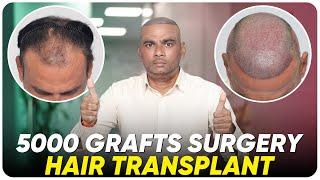 Hair Transplant in Ahmedabad | Best Results & Cost of Hair Transplant in Ahmedabad