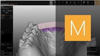 How to create a removable gingiva with flat base in Zirkonzahn.Modellier | Zirkonzahn.Software