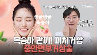 눈밑지방과 앞광대 처짐을 위한 하안검+피치거상술!