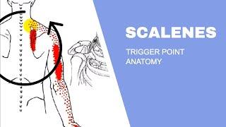 Scalenes Trigger Points