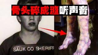 【骨裂癖】把全身骨头敲碎听声音，满足迷之癖好【郑郑得证】