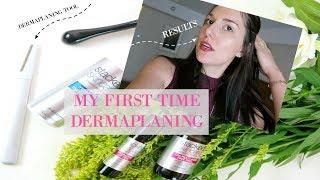 Dermaplaning for the First Time! | Adaleta Avdic