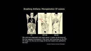 Hybrid Imaging Systems
