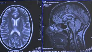 Top brain research centre opens in France