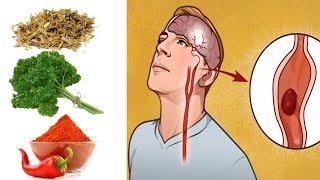 6 Herbs That Unclog Arteries & Improve Blood Circulation