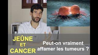 Jeûne et cancer :  Peut-on vraiment affamer les tumeurs?