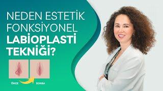 Neden Estetik Fonksiyonel Labioplasti Tekniği?