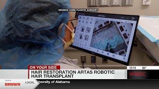 Hair Restoration Artas Robotic hair transplant