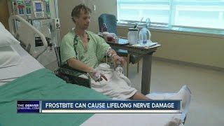 Frostbite can cause lifelong damage