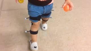 Children Gait Analysis - Clinical 3DMA