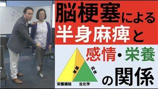 脳梗塞による半身麻痺と感情・栄養との関係