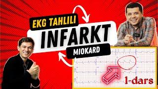 MIOKARD INFARKTI EKG TAHLILI