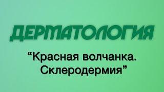 Дерматология №5 "Красная волчанка. Склеродермия"